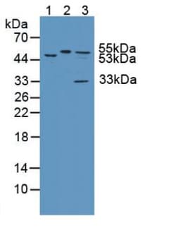 Invitrogen KATNA1 Polyclonal Antibody 20 &mu;L; Unconjugated:Antibodies,