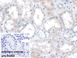 Invitrogen KATNA1 Polyclonal Antibody 200 &mu;L; Unconjugated:Antibodies,