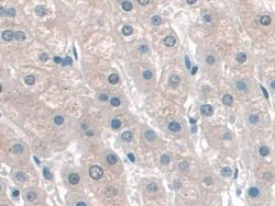Invitrogen KATNA1 Polyclonal Antibody 200 &mu;L; Unconjugated:Antibodies,