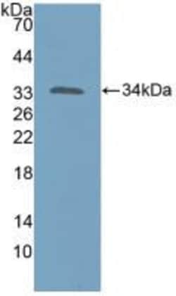 Invitrogen KATNA1 Polyclonal Antibody 200 &mu;L; Unconjugated:Antibodies,
