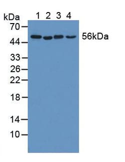 Invitrogen KATNA1 Polyclonal Antibody 200 &mu;L; Unconjugated:Antibodies,