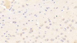 Invitrogen KELL Polyclonal Antibody 20 &mu;L; Unconjugated:Antibodies,
