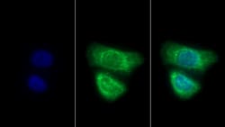 Invitrogen Cytokeratin 3 Polyclonal Antibody:Antibodies:Primary Antibodies