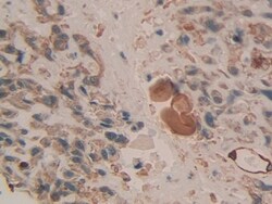 Invitrogen Cytokeratin 3 Polyclonal Antibody:Antibodies:Primary Antibodies