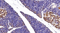 Invitrogen Cytokeratin 3 Polyclonal Antibody:Antibodies:Primary Antibodies