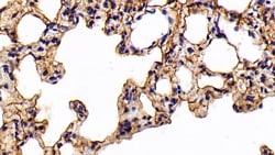 Invitrogen Cytokeratin 3 Polyclonal Antibody:Antibodies:Primary Antibodies
