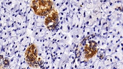 Invitrogen Cytokeratin 3 Polyclonal Antibody:Antibodies:Primary Antibodies