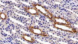 Invitrogen Cytokeratin 3 Polyclonal Antibody:Antibodies:Primary Antibodies