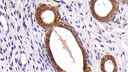 Invitrogen Cytokeratin 3 Polyclonal Antibody:Antibodies:Primary Antibodies