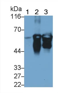 Invitrogen Cytokeratin 3 Polyclonal Antibody:Antibodies:Primary Antibodies