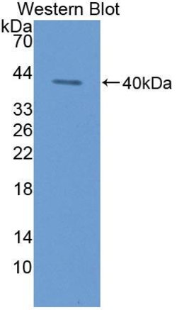 Invitrogen Cytokeratin 3 Polyclonal Antibody:Antibodies:Primary Antibodies