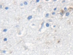 Invitrogen KRT33A Polyclonal Antibody:Antibodies:Primary Antibodies