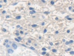 Invitrogen KRT33A Polyclonal Antibody:Antibodies:Primary Antibodies