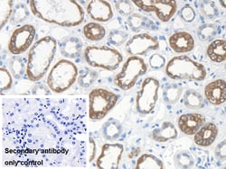 Invitrogen KRT33A Polyclonal Antibody 20 &mu;L; Unconjugated:Antibodies,