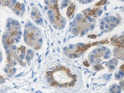Invitrogen KRT33A Polyclonal Antibody:Antibodies:Primary Antibodies