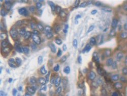 Invitrogen KRT33A Polyclonal Antibody:Antibodies:Primary Antibodies