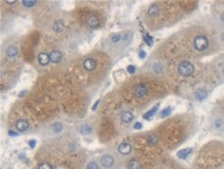 Invitrogen KRT33A Polyclonal Antibody:Antibodies:Primary Antibodies
