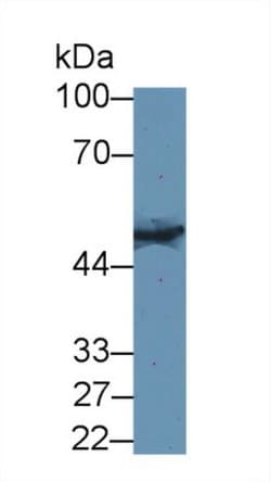 Invitrogen KRT33A Polyclonal Antibody:Antibodies:Primary Antibodies