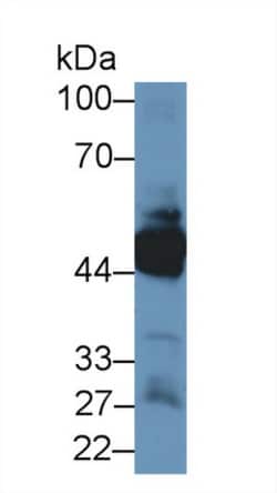 Invitrogen KRT33A Polyclonal Antibody 20 &mu;L; Unconjugated:Antibodies,