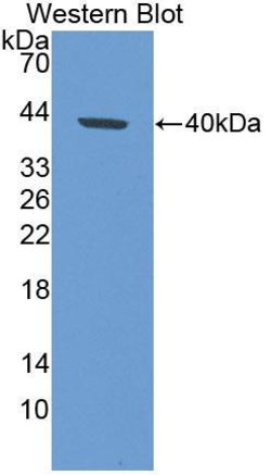 Invitrogen KRT33A Polyclonal Antibody:Antibodies:Primary Antibodies