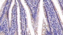 Invitrogen LDHB Polyclonal Antibody:Antibodies:Primary Antibodies