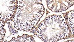 Invitrogen LDHB Polyclonal Antibody:Antibodies:Primary Antibodies
