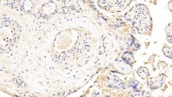 Invitrogen LDHB Polyclonal Antibody 20 &mu;L; Unconjugated:Antibodies,