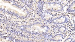 Invitrogen LDHB Polyclonal Antibody 20 &mu;L; Unconjugated:Antibodies,