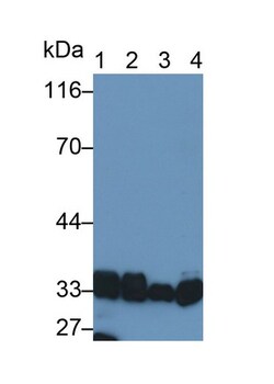 Invitrogen LDHB Polyclonal Antibody:Antibodies:Primary Antibodies