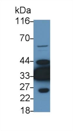 Invitrogen LDHB Polyclonal Antibody 20 &mu;L; Unconjugated:Antibodies,
