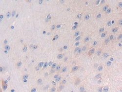 Invitrogen LTBP1 Polyclonal Antibody:Antibodies:Primary Antibodies
