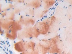 Invitrogen LTBP1 Polyclonal Antibody:Antibodies:Primary Antibodies