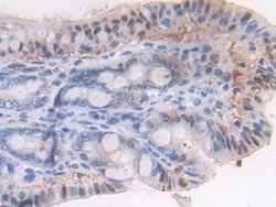 Invitrogen LTBP1 Polyclonal Antibody:Antibodies:Primary Antibodies