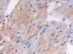 Invitrogen LTBP1 Polyclonal Antibody:Antibodies:Primary Antibodies