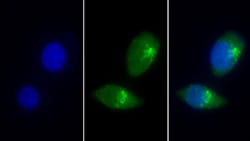 Invitrogen LMAN1 Polyclonal Antibody 200 &mu;L; Unconjugated:Antibodies,