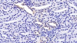 Invitrogen LMAN1 Polyclonal Antibody 200 &mu;L; Unconjugated:Antibodies,