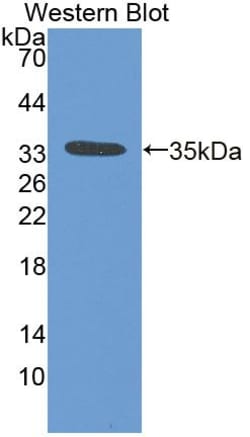 Invitrogen VIP36 Polyclonal Antibody 200 &mu;L; Unconjugated:Antibodies,