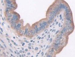 Invitrogen LEPR Polyclonal Antibody:Antibodies, Polyclonal