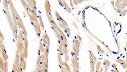 Invitrogen LEPR Polyclonal Antibody:Antibodies, Polyclonal