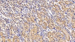 Invitrogen LEPR Polyclonal Antibody:Antibodies, Polyclonal