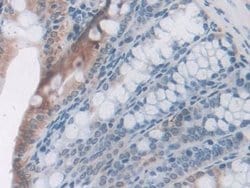 Invitrogen LEPR Polyclonal Antibody:Antibodies, Polyclonal