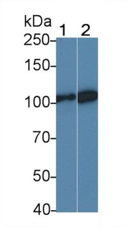 Invitrogen LEPR Polyclonal Antibody:Antibodies, Polyclonal