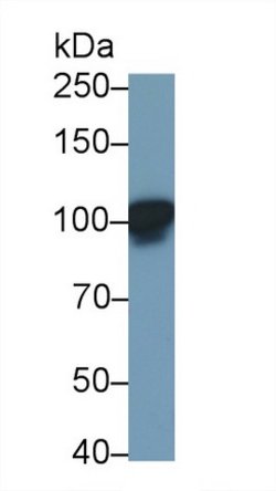 Invitrogen LEPR Polyclonal Antibody:Antibodies, Polyclonal