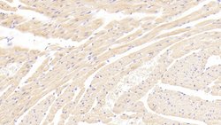 Invitrogen LEPR Polyclonal Antibody:Antibodies:Primary Antibodies