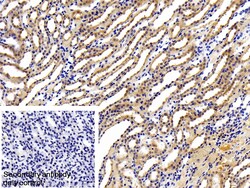 Invitrogen LEPR Polyclonal Antibody:Antibodies:Primary Antibodies