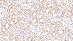 Invitrogen LEPR Polyclonal Antibody:Antibodies:Primary Antibodies