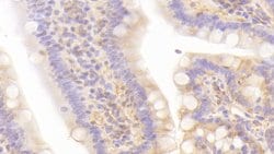 Invitrogen LEPR Polyclonal Antibody:Antibodies:Primary Antibodies