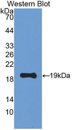 Invitrogen LEPR Polyclonal Antibody:Antibodies:Primary Antibodies
