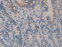 Invitrogen SERPINB1 Polyclonal Antibody:Antibodies:Primary Antibodies