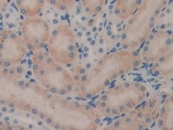 Invitrogen SERPINB1 Polyclonal Antibody:Antibodies:Primary Antibodies